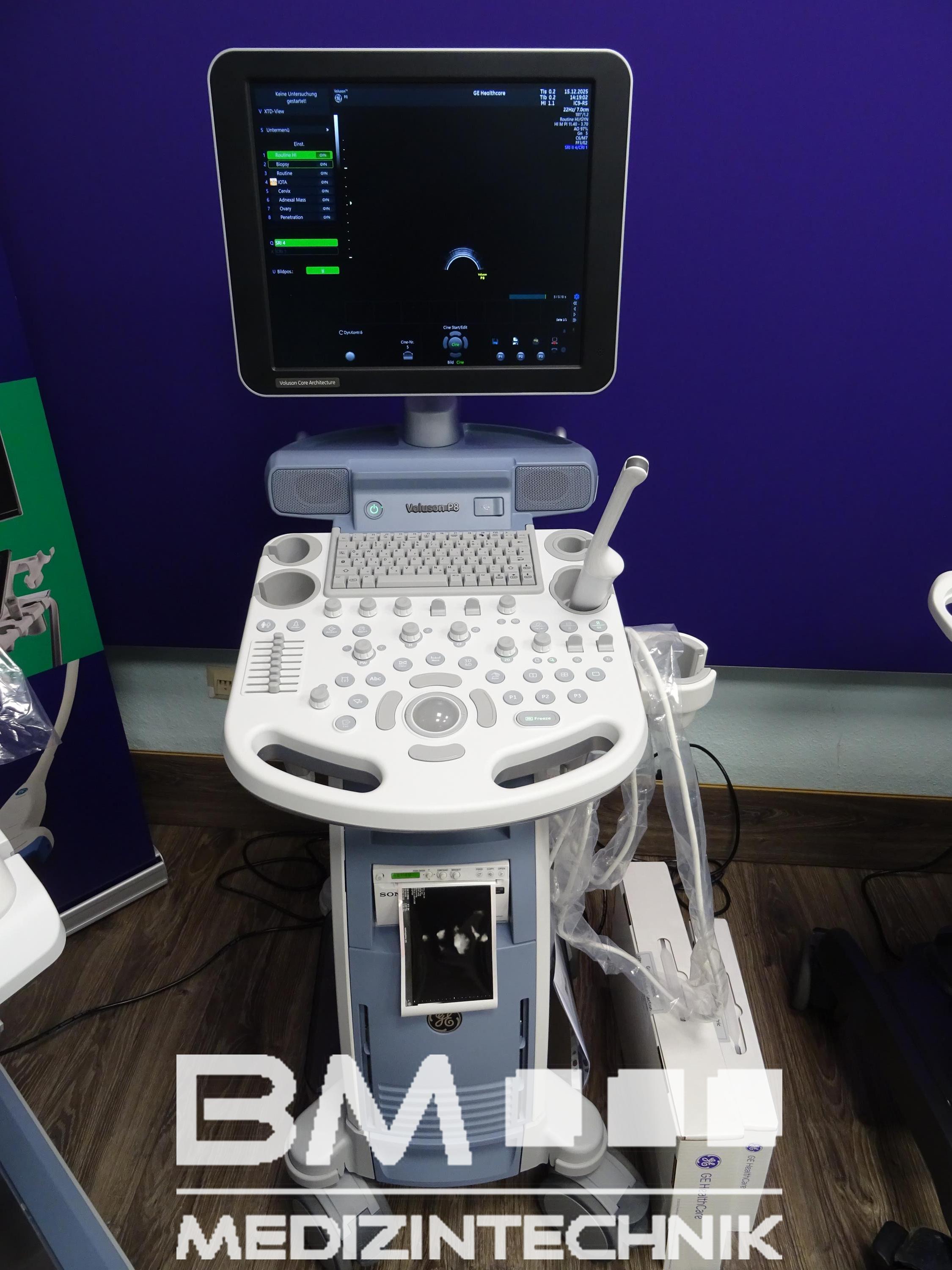 GE Voluson P8 BT22 GE Voluson P8 BT22